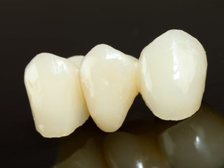 Dental Crowns & Bridges in Goldsboro, NC