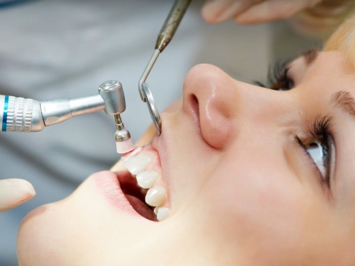 Dental Cleaning & Consultation