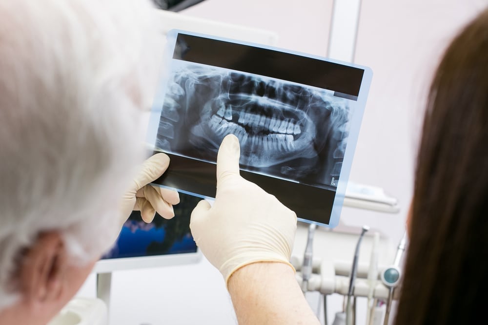 dental x-rays