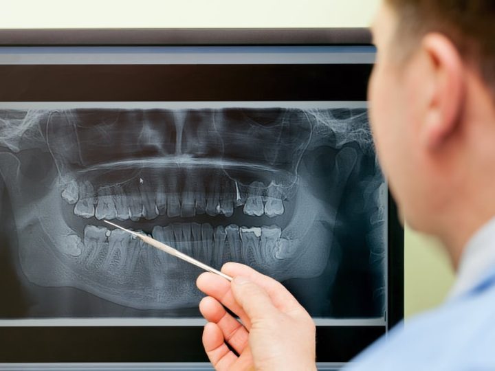 Digital X-Rays