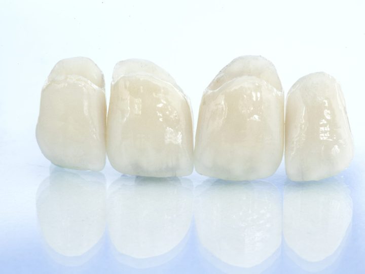 BruxZir Crown