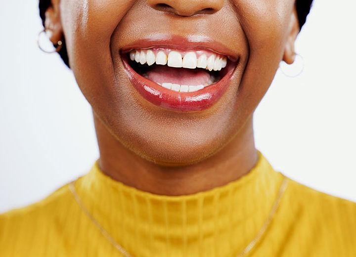 Understanding and Treating Bleeding Gums: A Guide from Stovall Dental