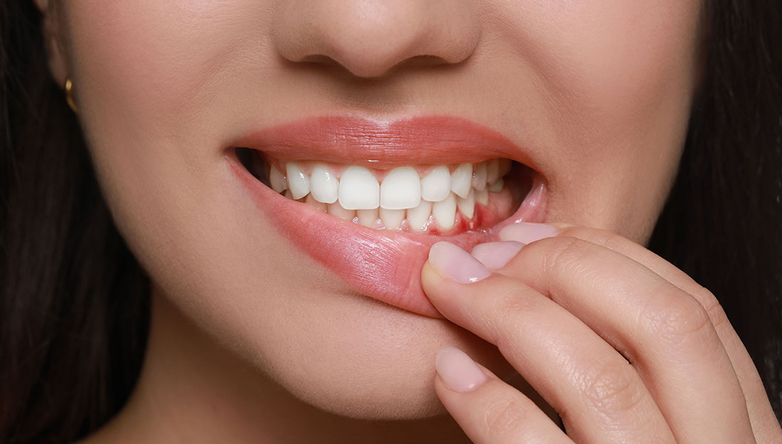 gum disease signs