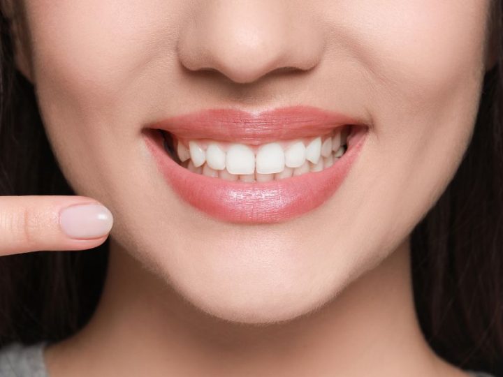 Gingivitis vs. Gum Disease: Understanding the Key Differences