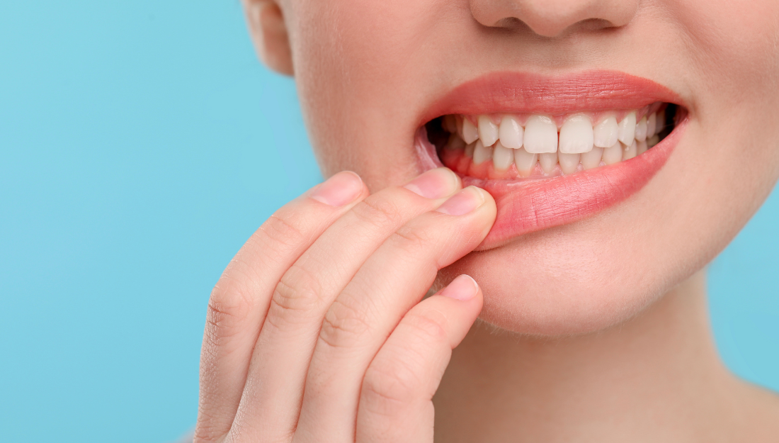 woman with periodontal disease