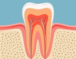 root canal treatment