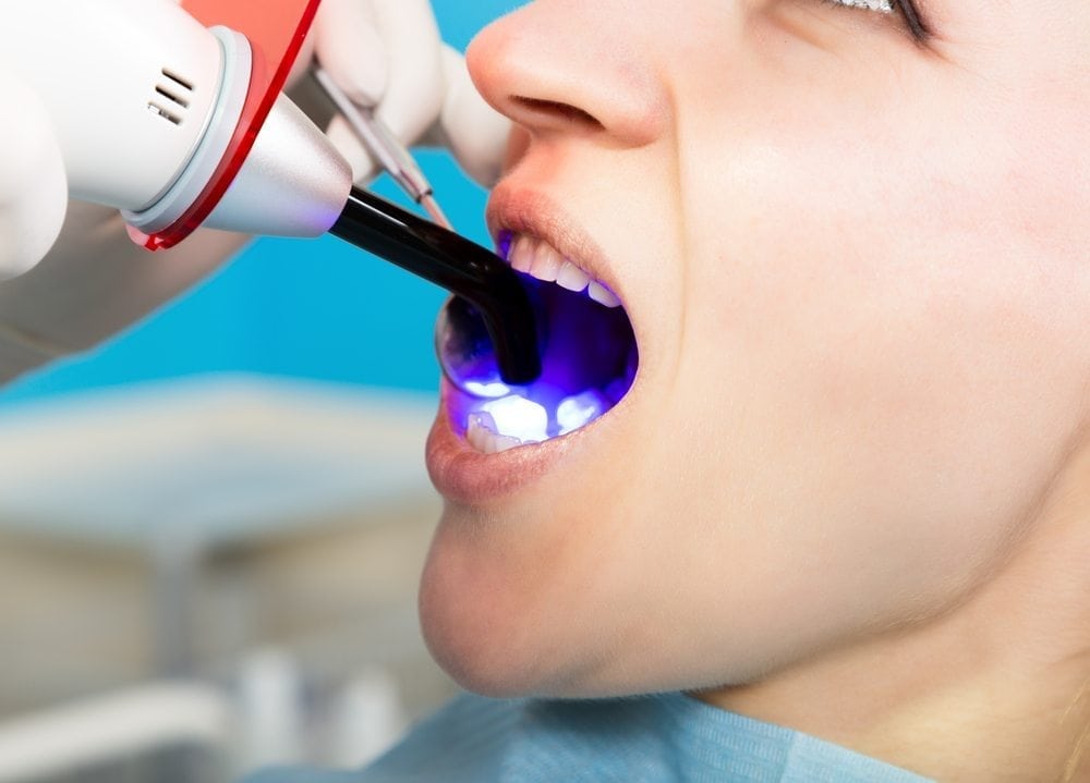 patient receiving dental bonding procedure from doctor